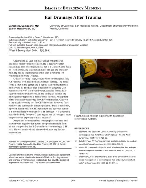 halo sign csf|Ear Drainage After Trauma